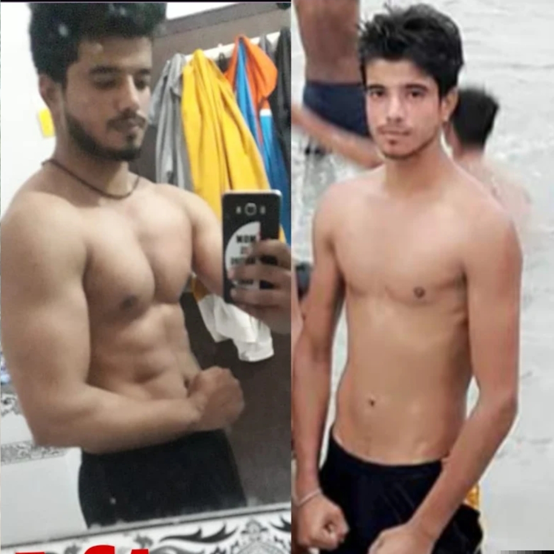 Upload Client Before-After Transformation Photo