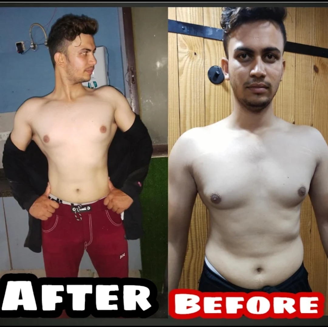 Upload Client Before-After Transformation Photo